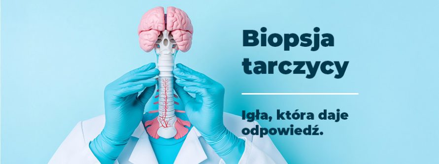 biopsja tarczycy