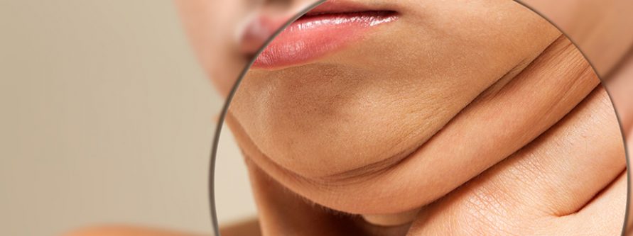 drugi podbrodek sprawdz czy plastyka podbrodka to rozwiazanie dla ciebie