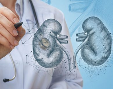 laserowe leczenie kamicy nerkowej RIRS