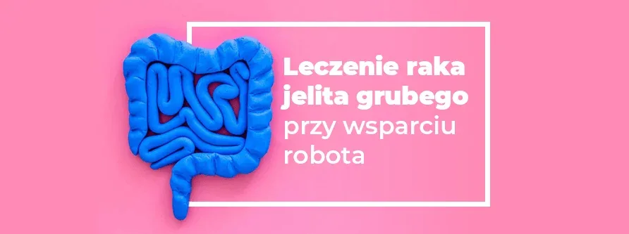 leczenie raka jelita grubego