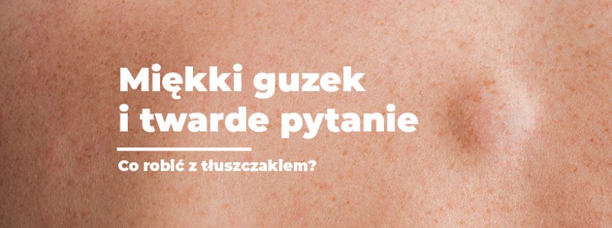 miekki guzek i twarde pytanie co robic z tluszczakiem