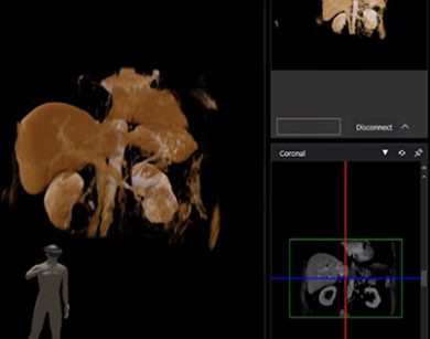 mieszana rzeczywistosc carnalife holo w zabiegach onkologicznych