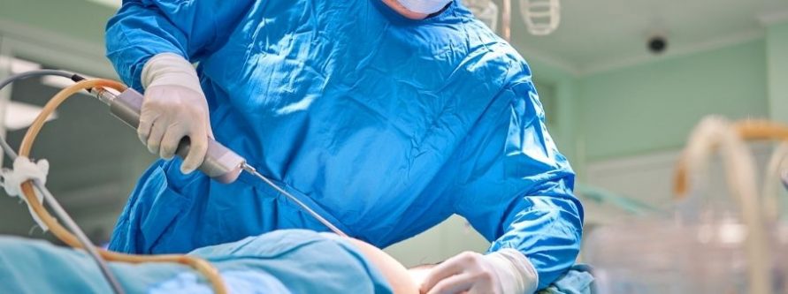 nie schudniesz na stole operacyjnym prawda o liposukcji