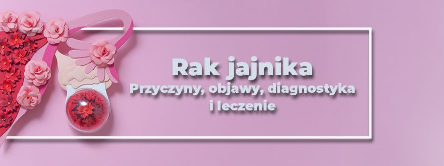 rak jajnika przyczyny objawy diagnostyka i leczenie
