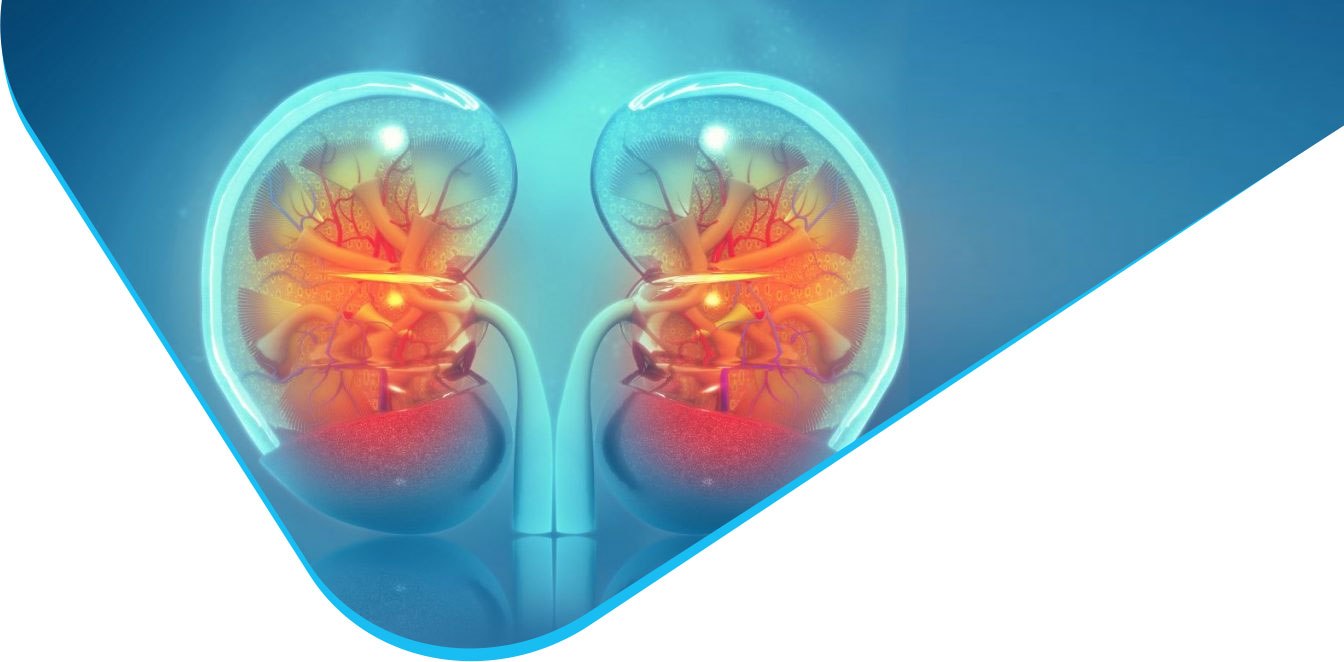 RIRS laserowe leczenie kamicy nerkowej