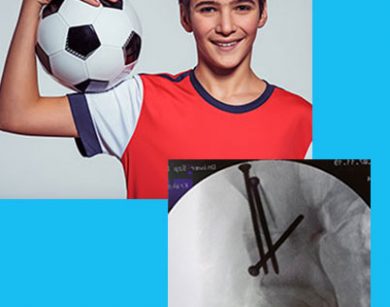 skomplikowany zabieg chirurgii oszczedzajacej staw biodrowy przeprowadzony u mlodego pacjenta