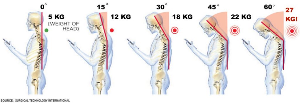 syndrom smarfonowej szyji