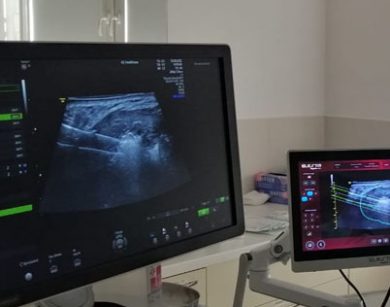 szpital na klinach w czolowce polskich osrodkow specjalizujacych sie w leczeniu lagodnych guzkow tarczycy z wykorzystaniem echolasera